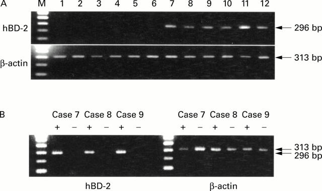 Figure 1  