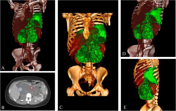 Fig. 2