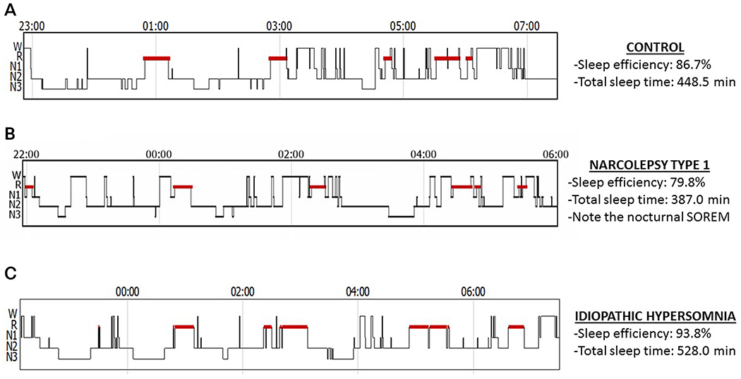 Figure 3-1