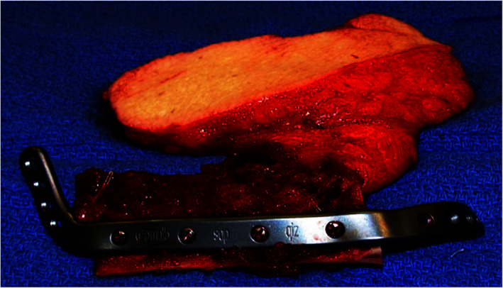 FIGURE 4