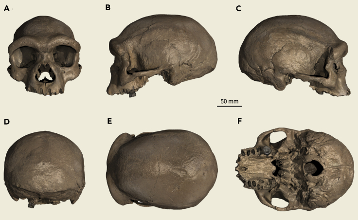 Figure 2