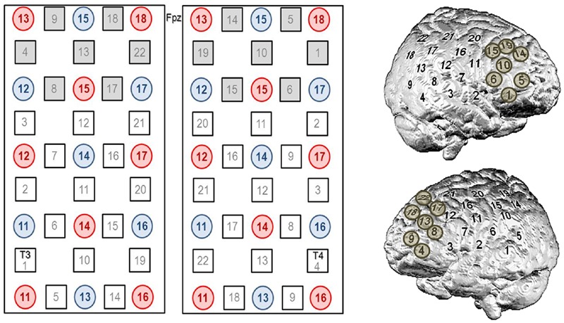 FIGURE 2