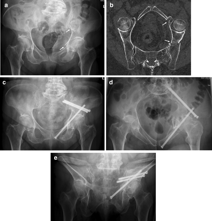 Fig. 3