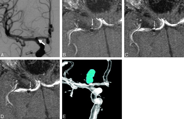 Fig 3.