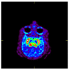 Fig 3