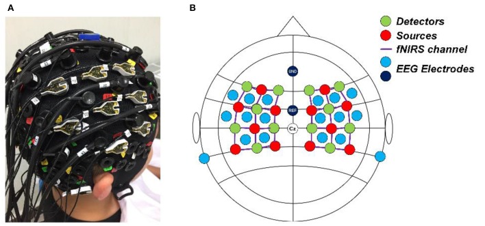 Figure 2