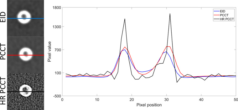 Line profiles of mean intensity images in a 5-mm phantom with three plaque components. The line profiles of energy-integrating detector (EID), photon-counting CT (PCCT), and high-resolution PCCT (HR-PCCT) for the three modes are shown. HR-PCCT shows less metal artifact and better representation of internal plaque components as seen in the middle of the image.