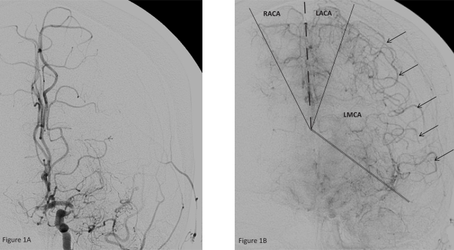 Figure 1, A and B.