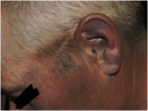 Fig 3