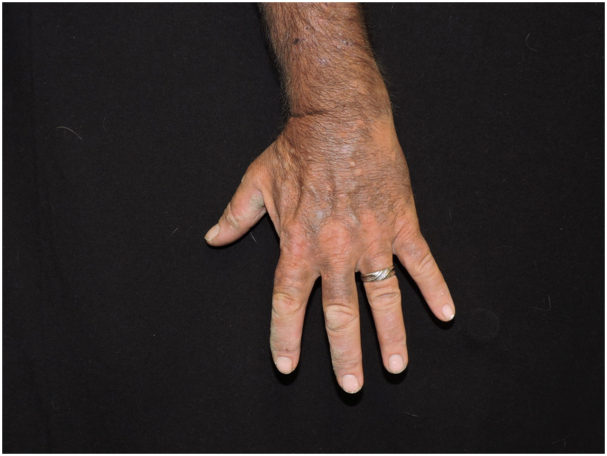 Fig 4