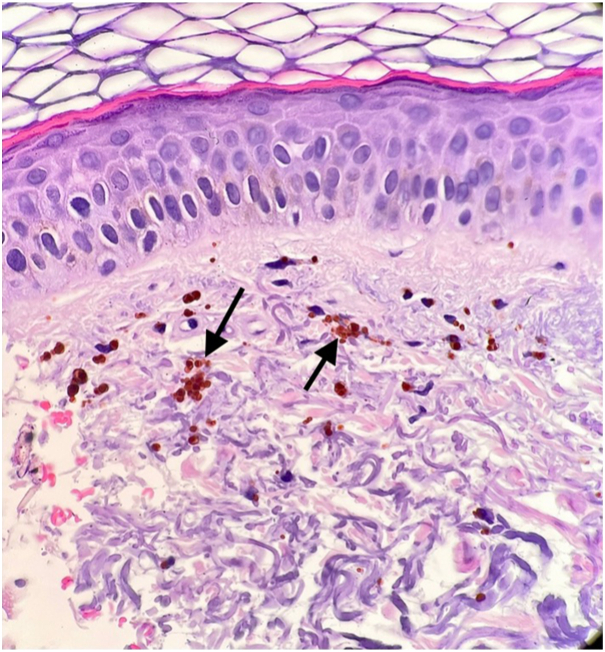 Fig 5