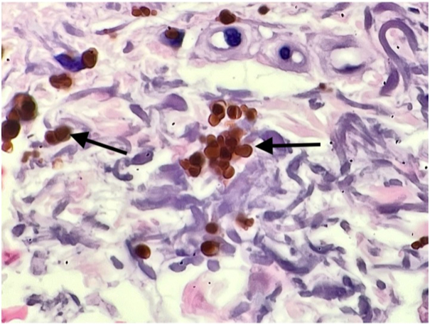 Fig 6
