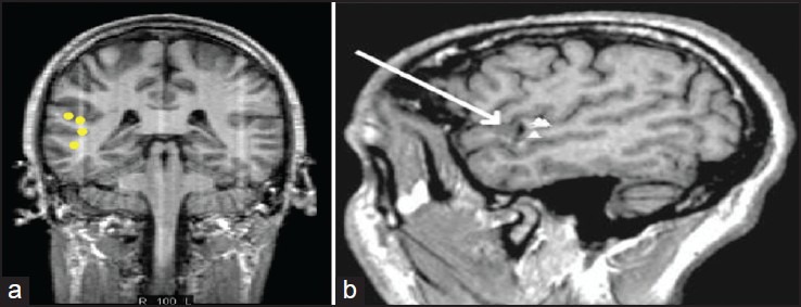 Figure 4a and b