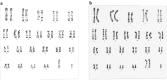 Fig 2: