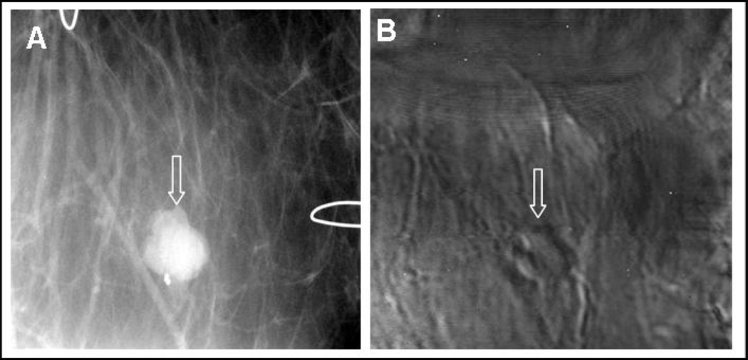 Fig. (3)