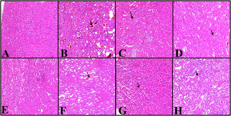 Figure 11.