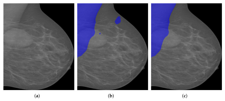 Figure 14