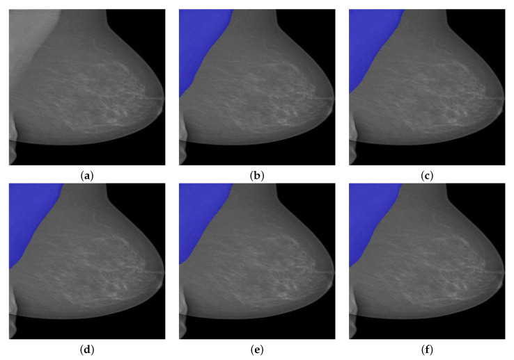 Figure 11