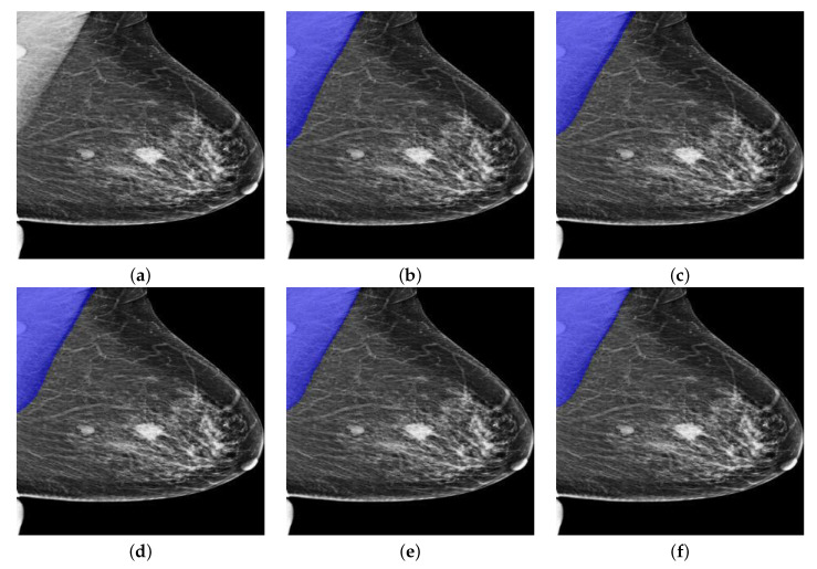 Figure 10