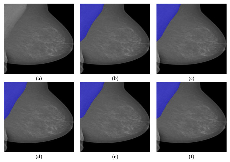 Figure 13