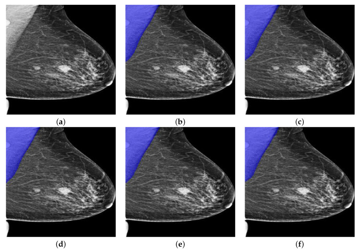 Figure 12