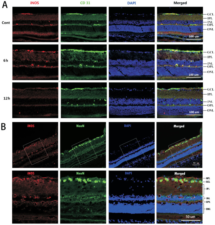 Dynamic Changes Of Inducible Nitric Oxide Synthase Expression In Rat S