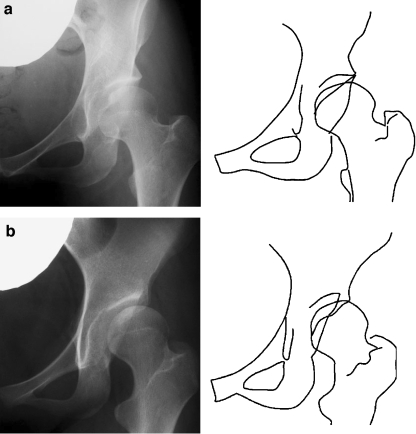 Fig. 1