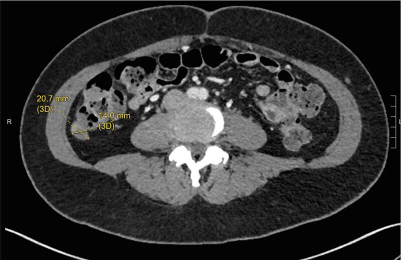 Fig. 2C