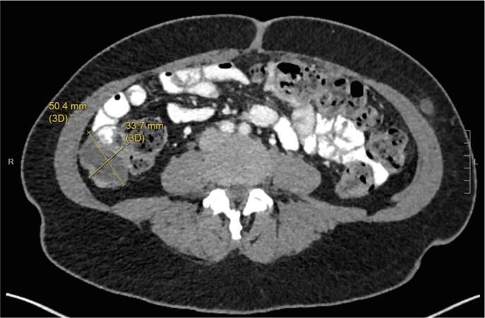 Fig. 2A