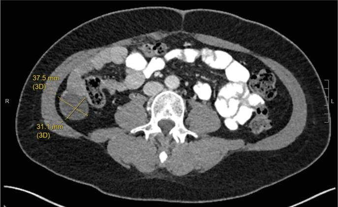 Fig. 2B