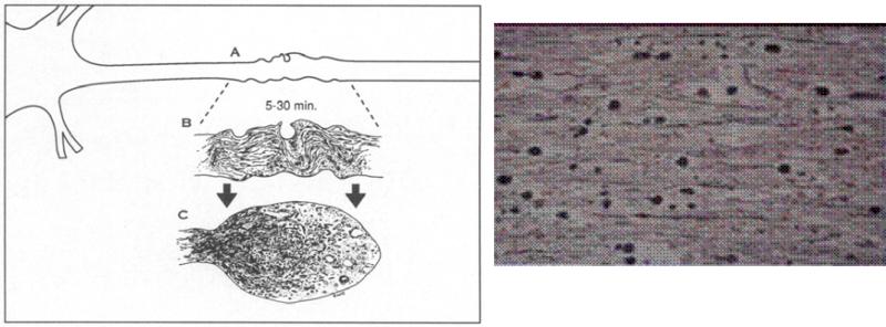 Fig.2