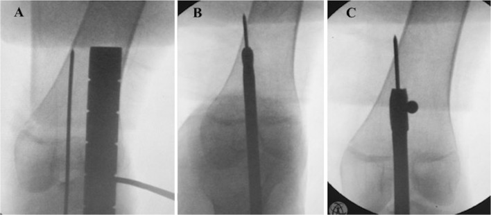 Fig. 5