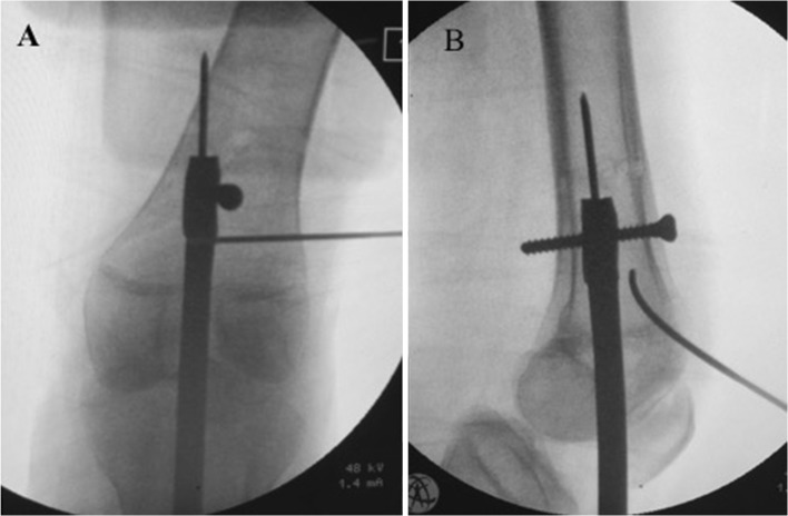 Fig. 6