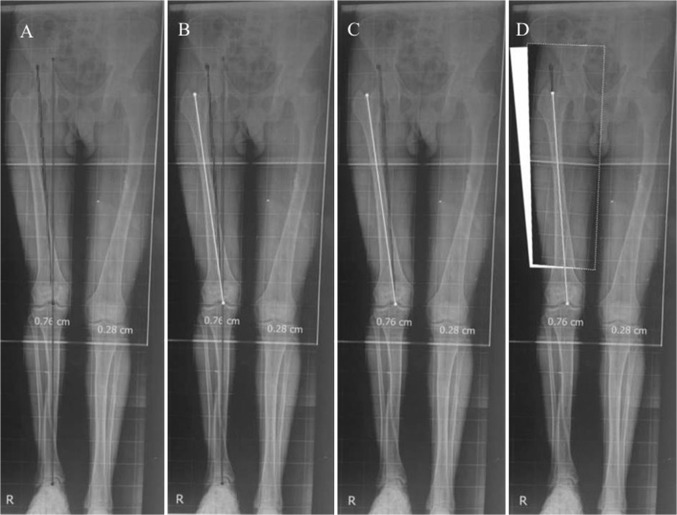 Fig. 4