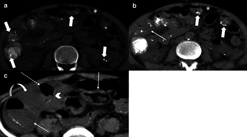 Fig. 26