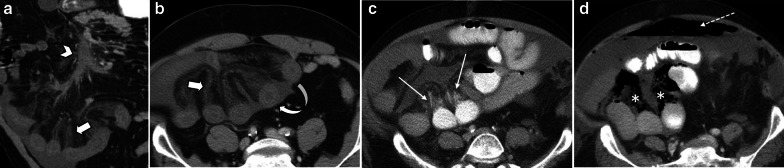 Fig. 14