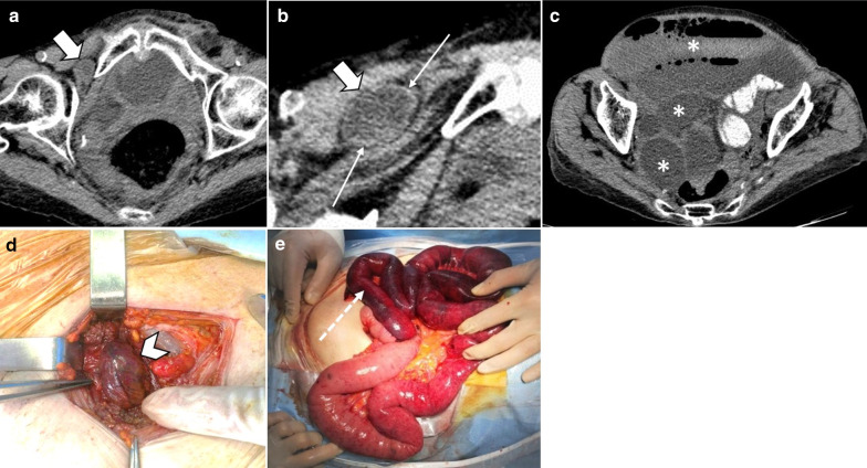 Fig. 18