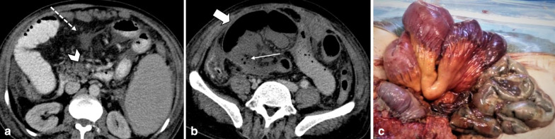 Fig. 15