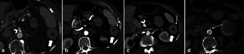 Fig. 10