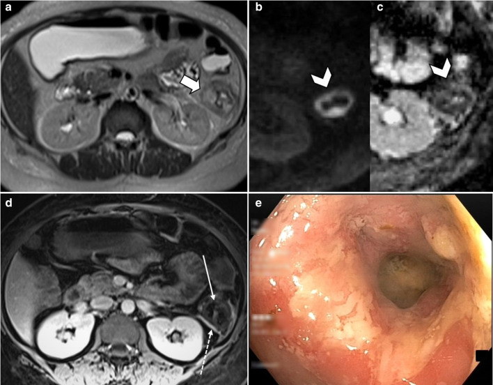 Fig. 12