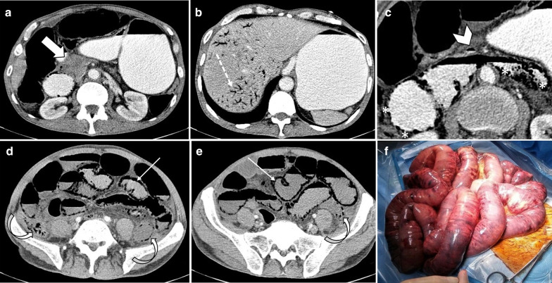 Fig. 22