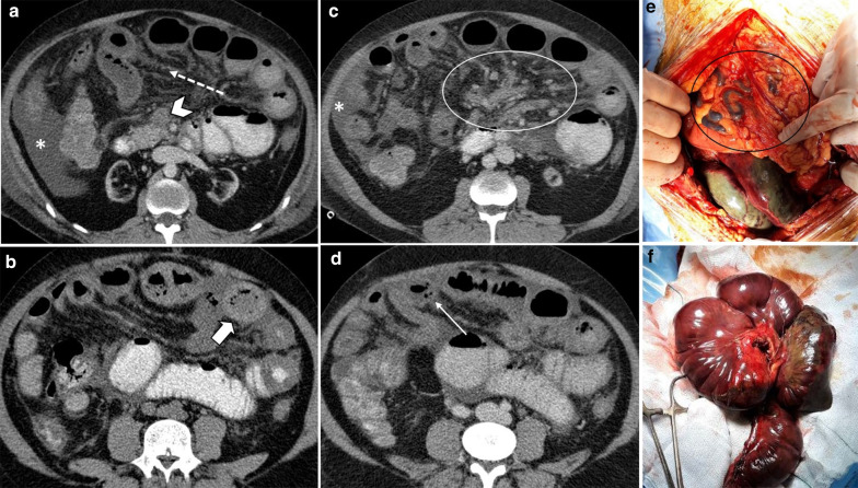 Fig. 13