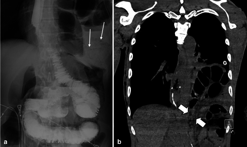 Fig. 19