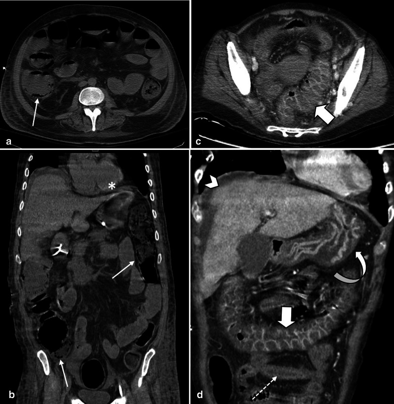 Fig. 17