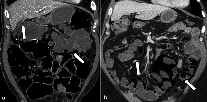 Fig. 31