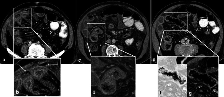 Fig. 8