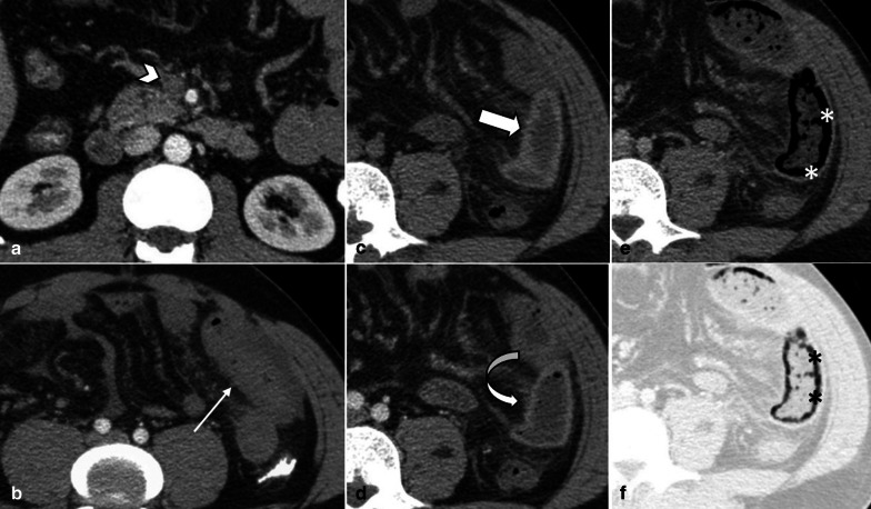 Fig. 6