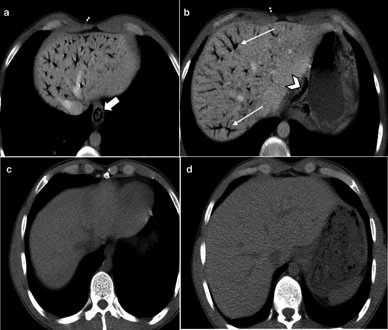 Fig. 32