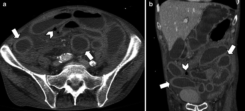 Fig. 23