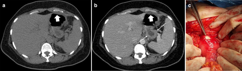 Fig. 27